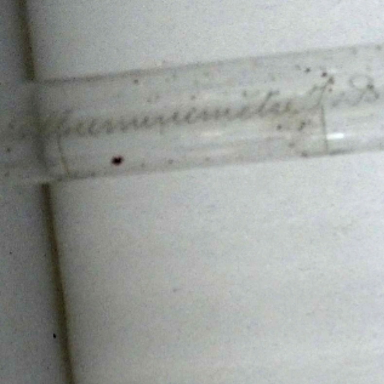 Tube d'Esbach, albuminimètre  - Vue 3 - 